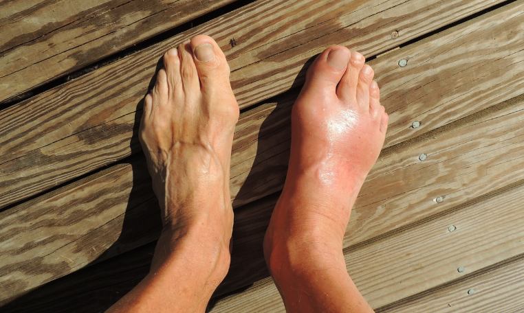 The Benefits of Custom Orthotics for Foot and Ankle Issues