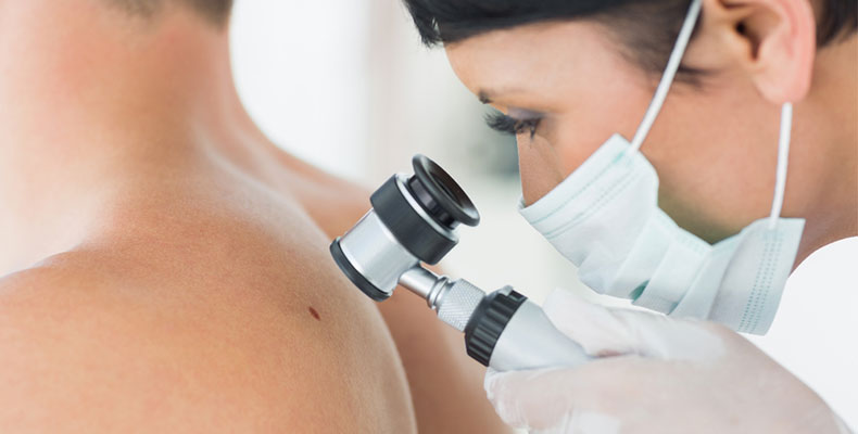 What You Need to Know About Visiting a Dermatologist for Skin Cancer