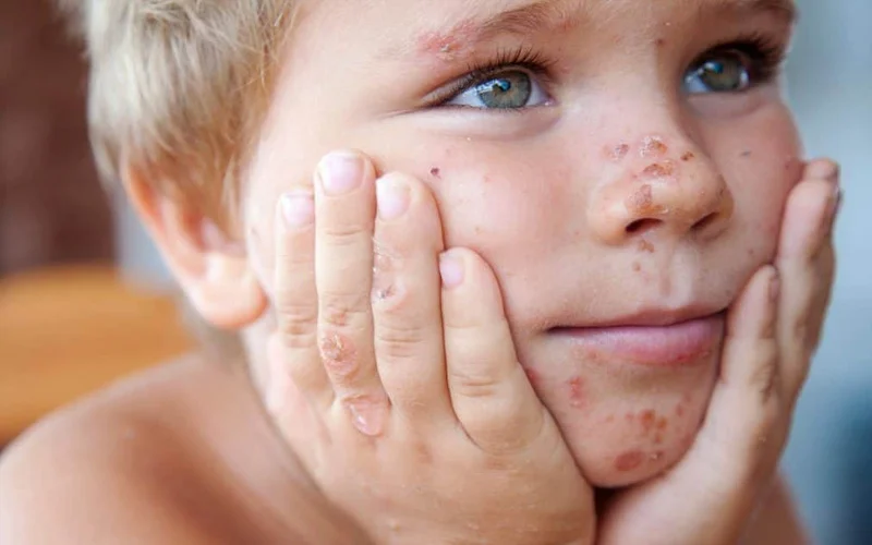 4 Treatments for Chronic Skin Conditions
