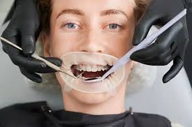 How Emergency Dentists Can Help with Lost or Damaged Teeth