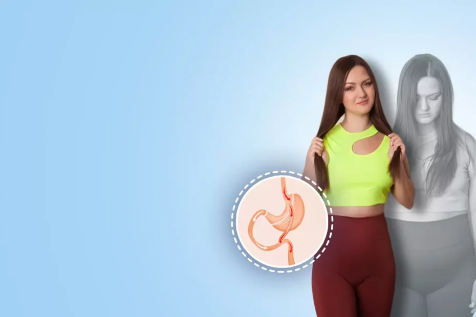 How Weight Loss Surgery Can Improve Your Quality of Life