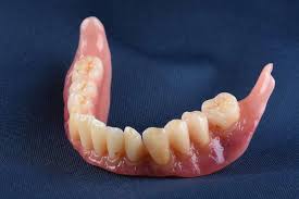 The Pros and Cons of Full vs. Partial Dentures