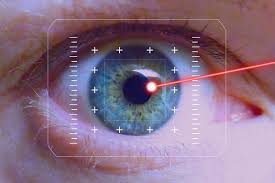 What To Know About Glaucoma Surgery and Recovery