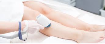4 Different Types of Laser Hair Removal Techniques