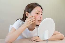 Common Skin Conditions Treated by Dermatologists