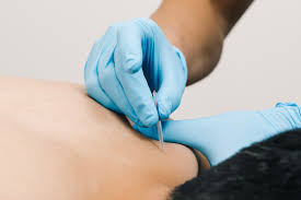 Effective Methods a Doctor Can Use to Manage Pain