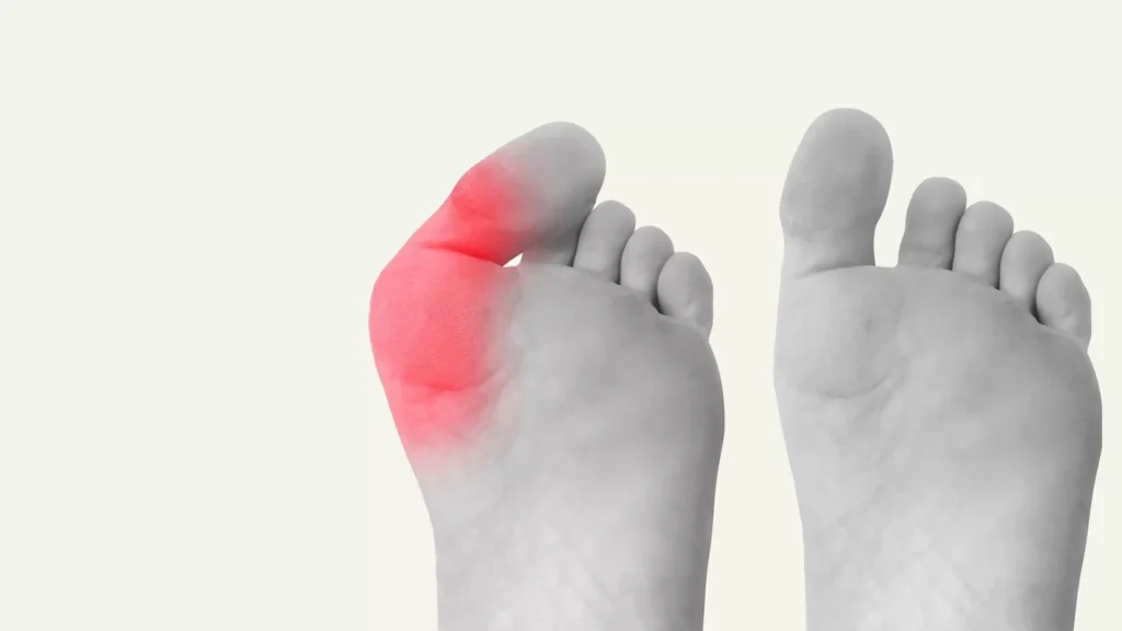 FAQs About the Expertise of a Foot and Ankle Surgeon