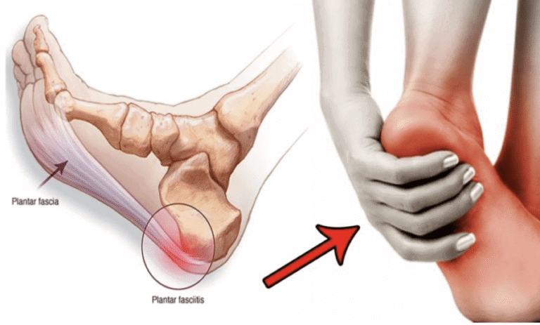 How Certain Foot Structures Lead to Pain and Discomfort