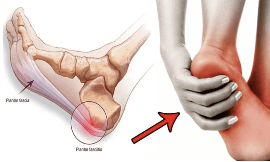 How Certain Foot Structures Lead to Pain and Discomfort