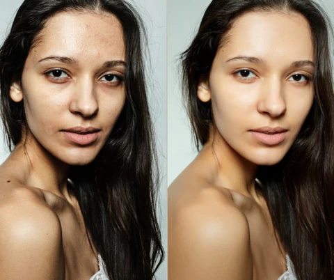 Is Kybella Right for You? Understanding the Treatment