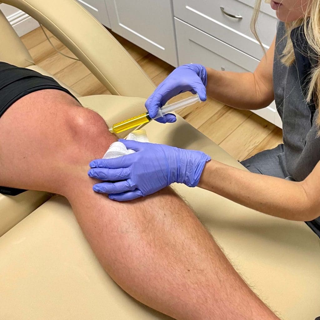 PRP for Athletes