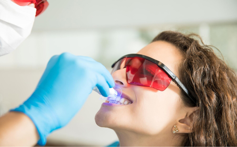 The Long-Term Benefits of Professional Teeth Whitening Treatments