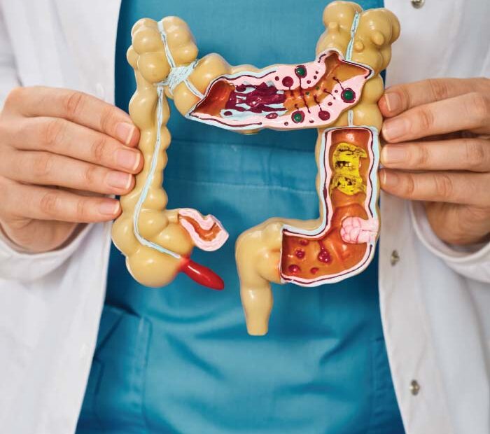 The Necessity of Regular Screenings for Colon Health